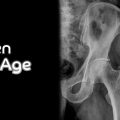 The Hidden Truth – Hips Widen with Age