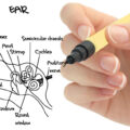 Representing vestibular rehab, this is an image of a hand with a pen drawing and labeling the anatomy of the inner ear.